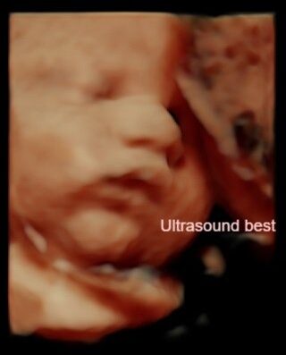 Ultrasound Best