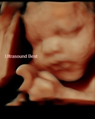 Ultrasound Best